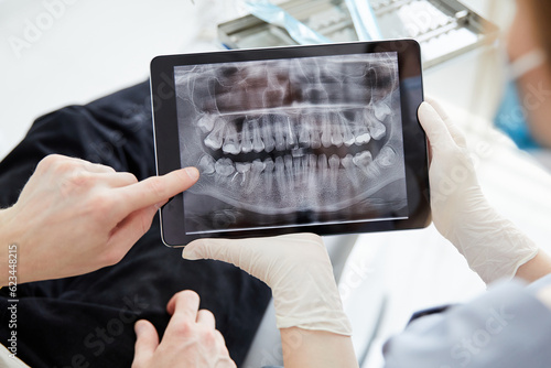 Close up woman dentist holding patient mouth digital film.The dentist explained about the oral cavity to the patient at the dental office