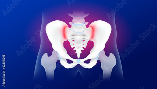 Human pelvis or hip bone anatomy isolated on blue background. Pelvic and hip joint pain. Arthritis cartilage becomes worn this results in inflammation swelling. Medical x ray film concept. 3d vector.