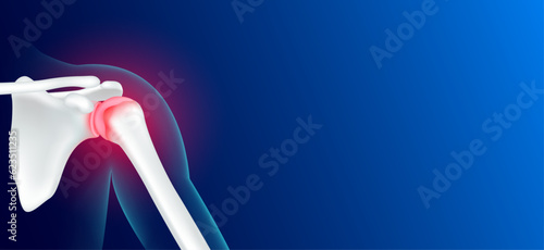 Shoulder bone pain and joint arthritis cartilage becomes worn this results in inflammation swelling. Human skeleton anatomy with copy space for text. Medical x ray film concept. Realistic 3D vector.