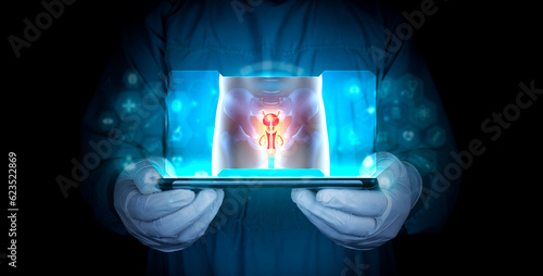 Male reproductive system. Erectile dysfunction, priapism, Peyronie's disease, orchitis, varicocele, hydrocele. Doctor with tablet shows x-ray of male member on dark background photo