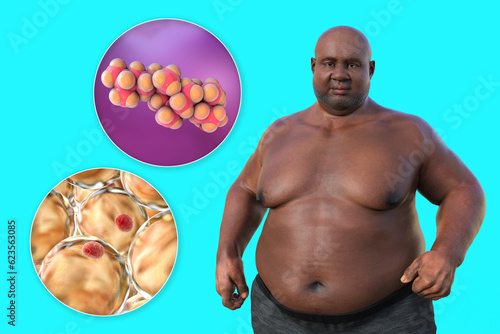 An overweight man with a close-up view of adipocytes and cholesterol molecules, 3D illustration