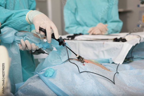 Doctor performs the operation using a camera and a laparoscopic instrument. Laparoscopic surgery. Penetration into the abdominal cavity. Surgical team.