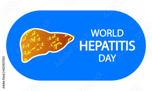 Hepatitis day world infographic, vector art illustration.
