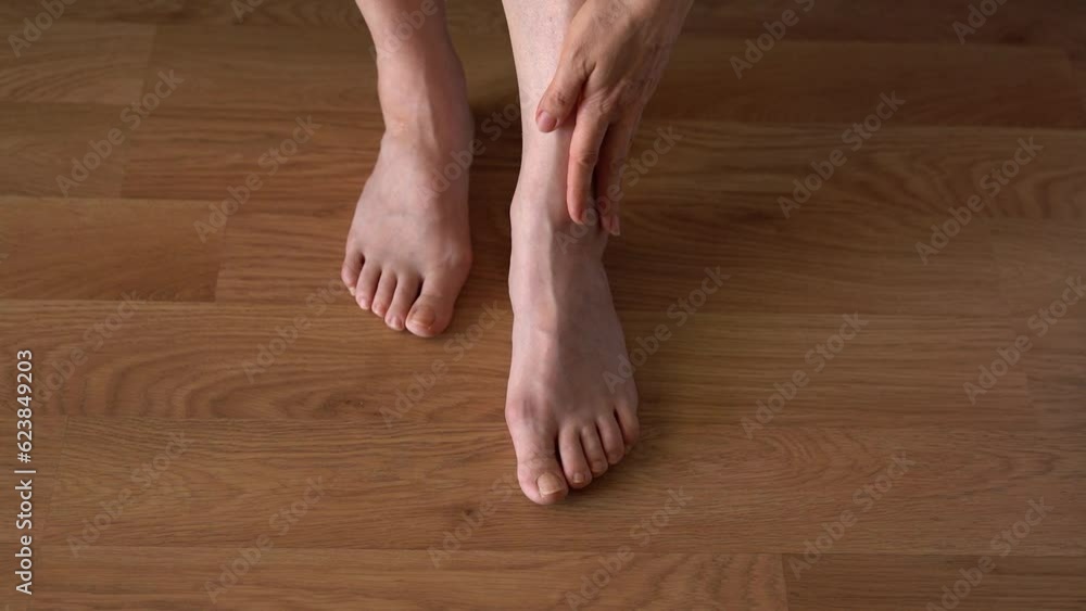 Hallux valgus on female legs on the background of laminate flooring. A bump on a woman's legs close-up. View from above. Hallux valgus on female legs on the background of laminate flooring. A bump on a woman's legs close-up. View from above.