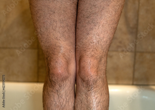 Woman with hairy legs 