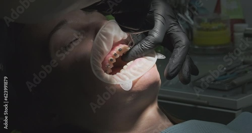 Patient squints in pain. Orthodontist removes braces with dental nippers. Open mouth with retractor, close-up. photo