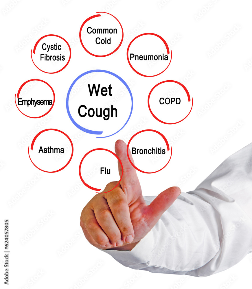 Eight Causes of Wet Cough. Eight Causes of Wet Cough.