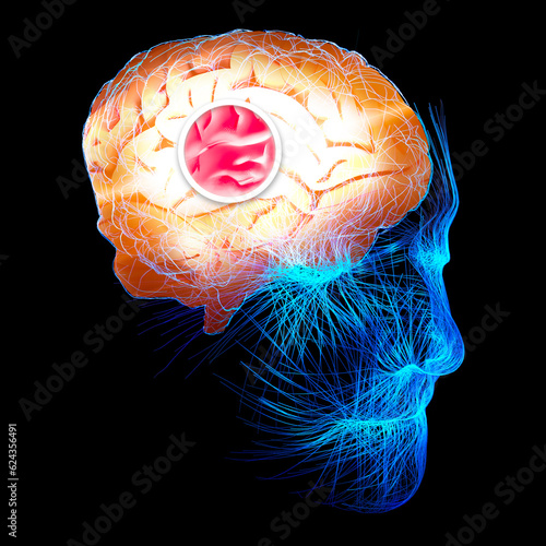 Brain connections. Neurons and synapses. Communication and cerebral stimulus. Neural network circuit, degenerative diseases, Parkinson, Alzheimer. 3d rendering photo