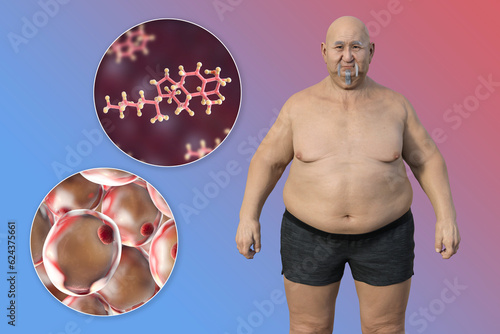 An overweight man with a close-up view of adipocytes and cholesterol molecules, 3D illustration