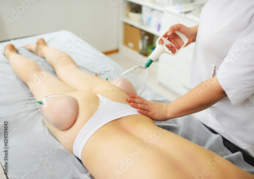 Vacuum massage of the buttocks. Hijama, cellulite removal from problem areas