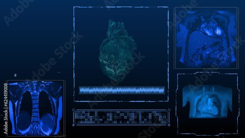 MRI x-ray images of the heart in different projections computer animation