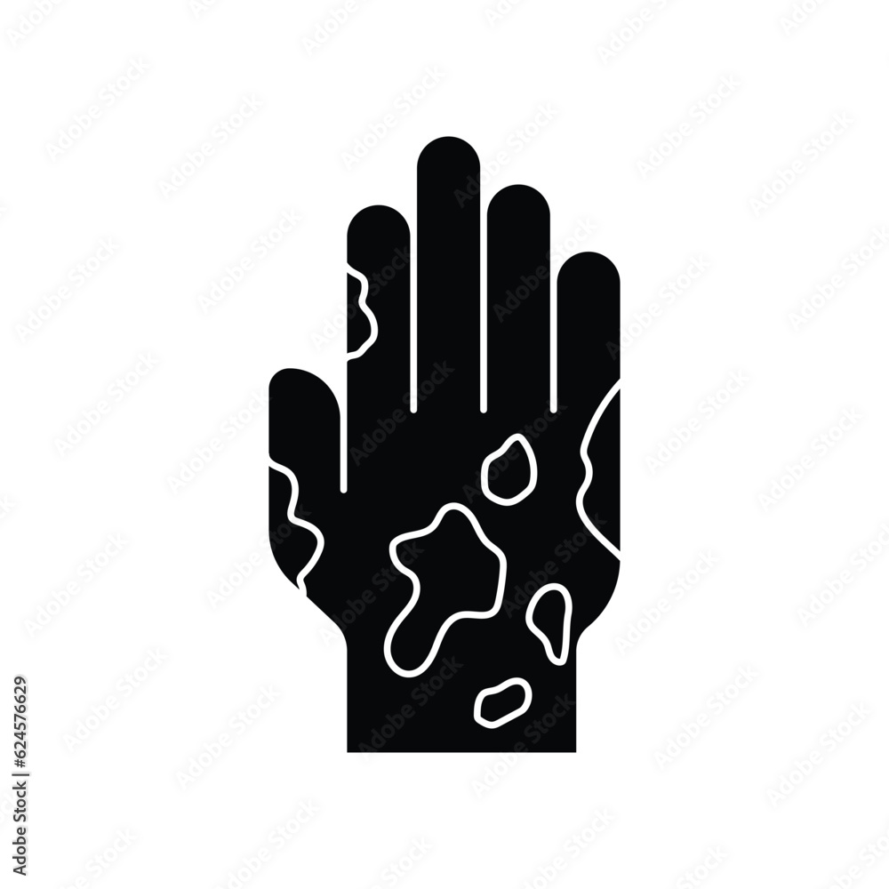 Obraz premium Eczema hand ski icon design. Rash hand icon, allergic reaction. isolated on white background. vector illustration