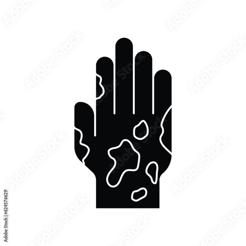 Eczema hand ski icon design. Rash hand icon, allergic reaction. isolated on white background. vector illustration