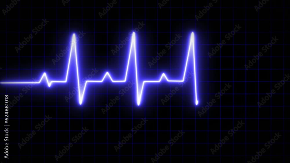 Monitor your heart rate Electrocardiogram Looping EKG or Ecg backdrop. Blue screen for an oscilloscope and a cardiogram Monitor your heart rate Electrocardiogram Looping EKG or Ecg backdrop. Blue screen for an oscilloscope and a cardiogram