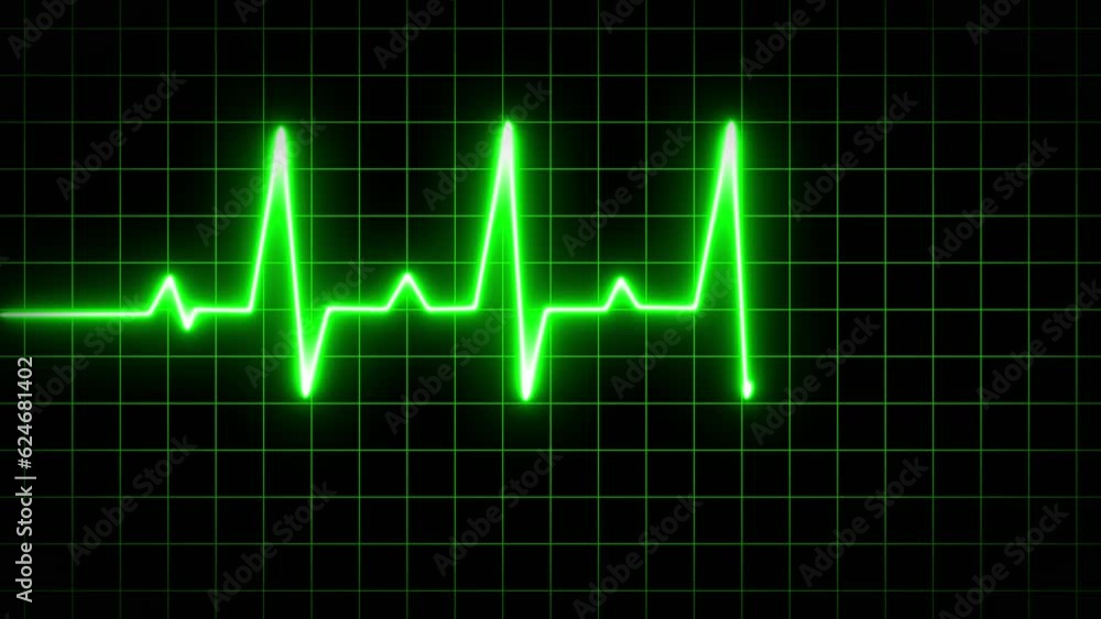 Heartbeat display animation. 4k infinite loopable. animation of an ecg ekg display