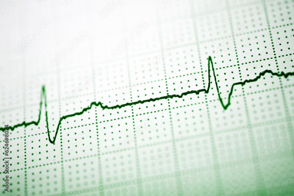 Close-up of an electrocardiogram printed on green paper. Close-up of an electrocardiogram printed on green paper.