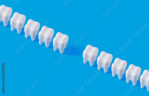 Fotobehang Row of white teeth and gap between them