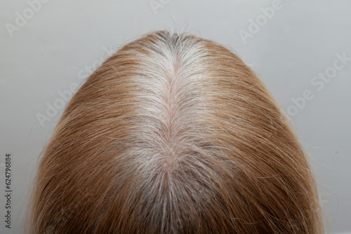 Canvastavla Gray hair roots on woman's head, close-up