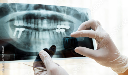 Fotografia Dentist examining a panoramic dental x-ray