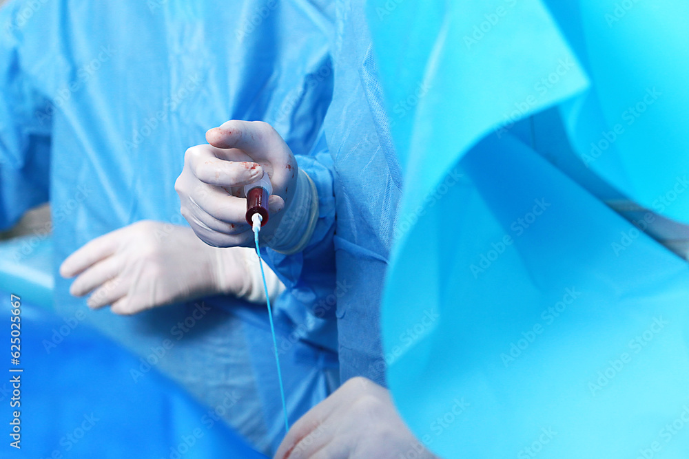 Surgery on blood vessels. Endovascular surgery. Removal of blood clots. Surgical interventions