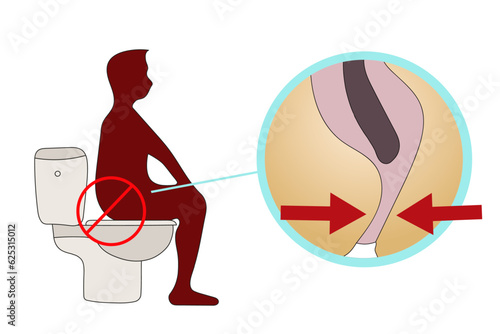 Medical cartoon on how to sit on the toilet correctly in vector illustration 