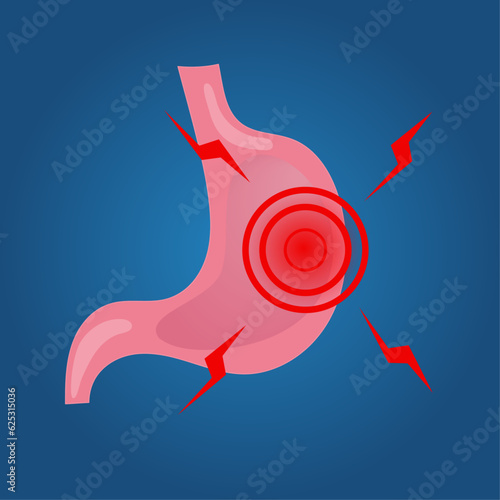 Medical cartoon of stomachache in vector illustration 