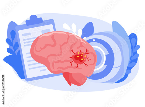 Brain cancer concept. Malignant tumor develops in the human brain. Cancer cell structure. flat vector illustration