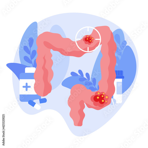 Pain or inflammation in the intestines. Anatomy of the intestine, appendix, rectum and colon. Cancer, tumor or infection and disease of the digestive system. Doctor appointment and help isolated vecto
