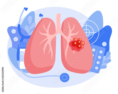 The concept of lung cancer. A malignant tumor develops in the lungs. The structure of a cancer cell. Flat vector illustration