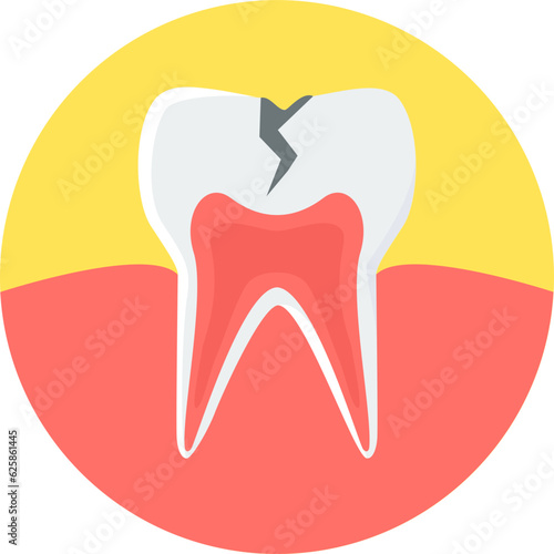Tooth Cavity