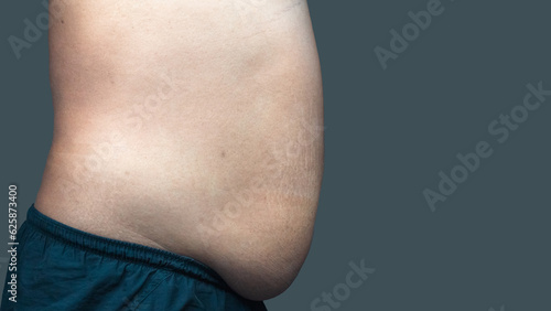 Fat mature man check out body overweight abdomen his belly for grey or obesity background. Weight loss concept.