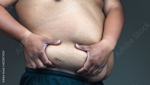 Fat mature man check out body overweight abdomen his belly for grey or obesity background. Weight loss concept.
