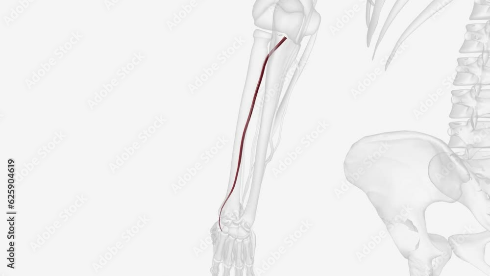 Posteriror inferior cerebellar artery and vertebral artery . Posteriror inferior cerebellar artery and vertebral artery .