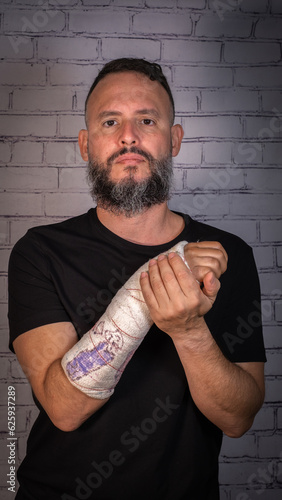 Young man with beard and without glasses, wearing a black T-shirt. Broken arm with plaster painted with children's drawings. Tenerife, Canary Islands, Spain.