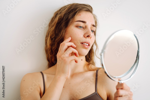 Skin problem. Curly woman touches red inflammations on her face while looking in the mirror in a bright room. Facial skin problems. Beauty care. Allergic reaction.
