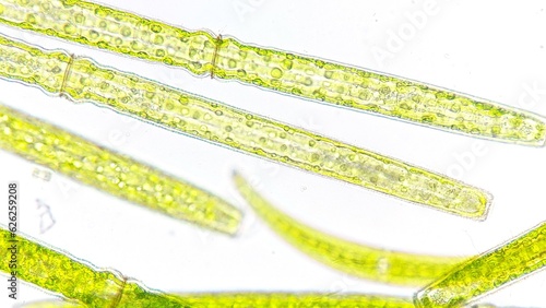 Freshwater microalgae (Pleurotaenium sp.) blooming under microscope. 760x magnification. Sampel was taken on July 8, 2023 (dry season). Location: Bogor regency, Indonesia photo