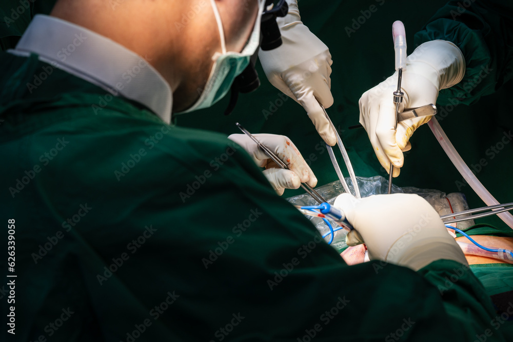 Medical team of surgeons in hospital working surgical intervention.Surgery operating room with electrocautery equipment for breast cosmetic.Surgeon gloved hands hold the instrument