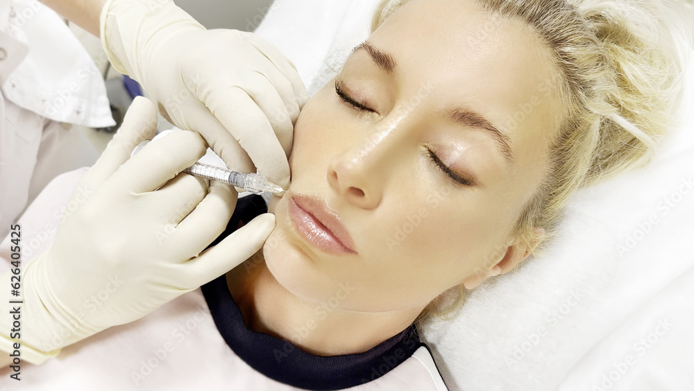 Hyaluronic acid injections for specific areas.Lip augmentation with hyaluronic acid fillers,using flexible hyaluronic acid fillers Hyaluronic acid injections for specific areas.Lip augmentation with hyaluronic acid fillers,using flexible hyaluronic acid fillers