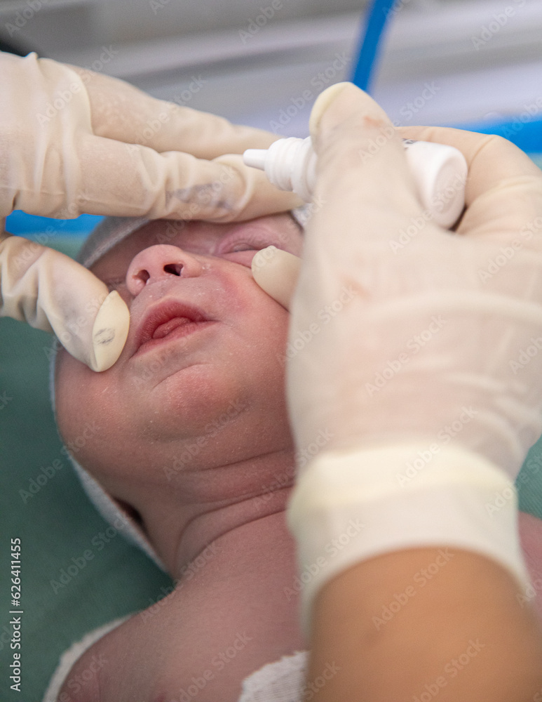 doctor applying eye drops to newborn