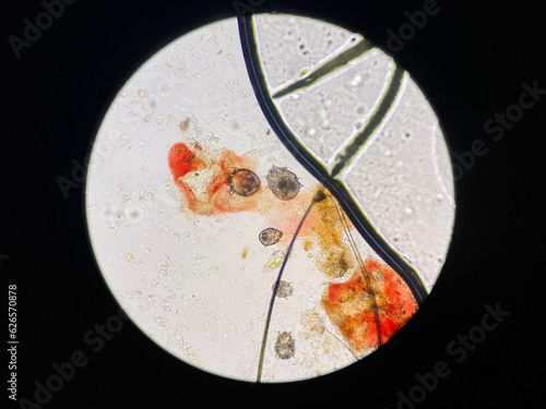 Notoedres cati under the microscope. Notoedric mange, also referred to as Feline scabies, is a highly contagious skin infestation caused by an ectoparasitic and skin burrowing mite Notoedres cati. photo