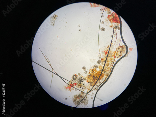 Notoedres cati under the microscope. Notoedric mange, also referred to as Feline scabies, is a highly contagious skin infestation caused by an ectoparasitic and skin burrowing mite Notoedres cati. photo