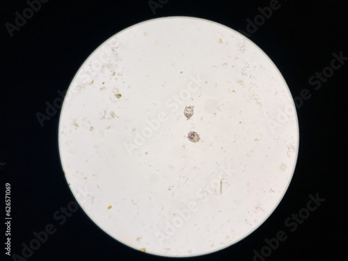 Notoedres cati under the microscope. Notoedric mange, also referred to as Feline scabies, is a highly contagious skin infestation caused by an ectoparasitic and skin burrowing mite Notoedres cati.