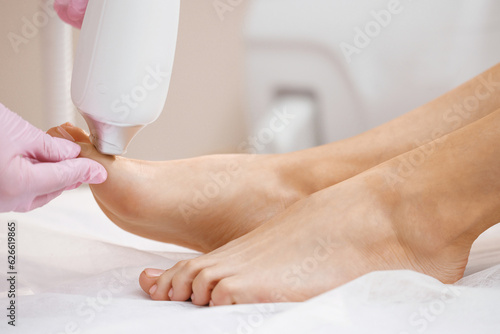The doctor makes the procedure for the treatment of foot fungus. Patient receiving laser therapy for a toenail. Fungal infection on the nails. Treatment of onychomycosis with a medical laser photo