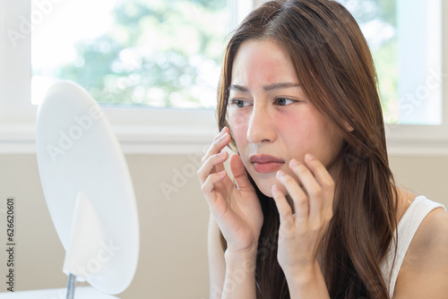 Fotografia Asian young woman looking face skin in the mirror have a red rash on her face fr