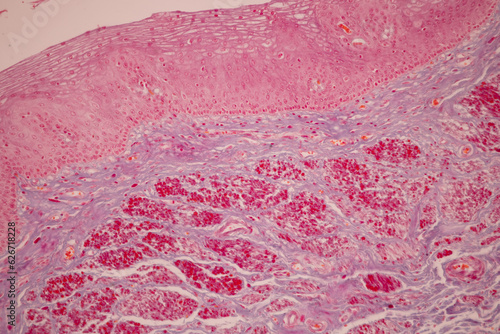 Showing Light micrograph of the Tongue human , Tooth human, Parotid  gland human and Oesophagus human under the microscope for education in the laboratory.