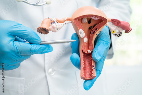 Фотография Uterus, doctor holding anatomy model for study diagnosis and treatment in hospital