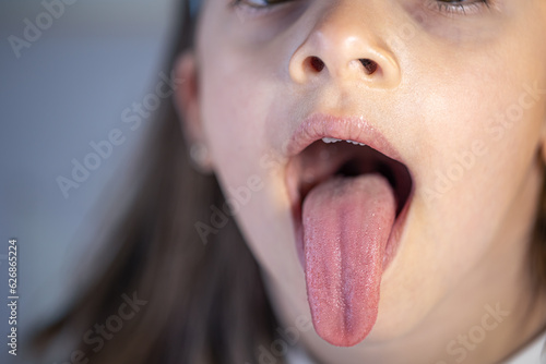Foto A child girl open her mouth and show her tounge.