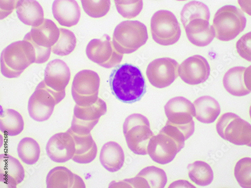 White blood cell in blood smear, analyze by microscope