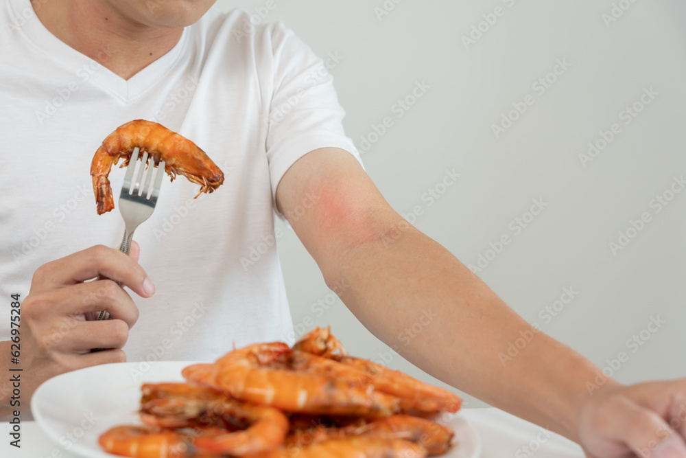 Foto Stock food allergies, men have reactions itching and redness after