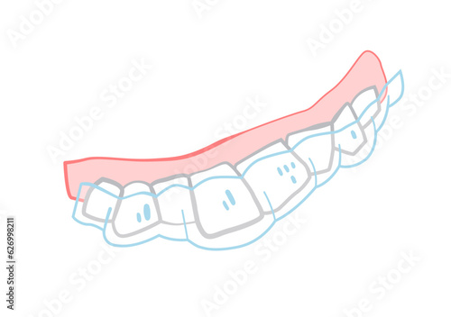 Orthodontic silicone trainer. Invisible braces retainer. Vector illustration